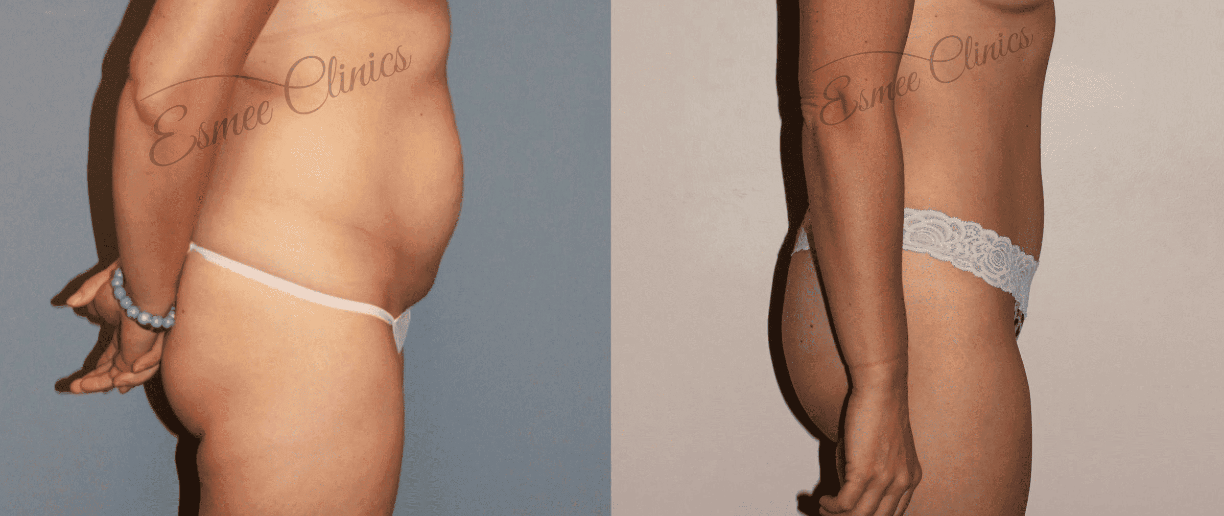 Before and After img